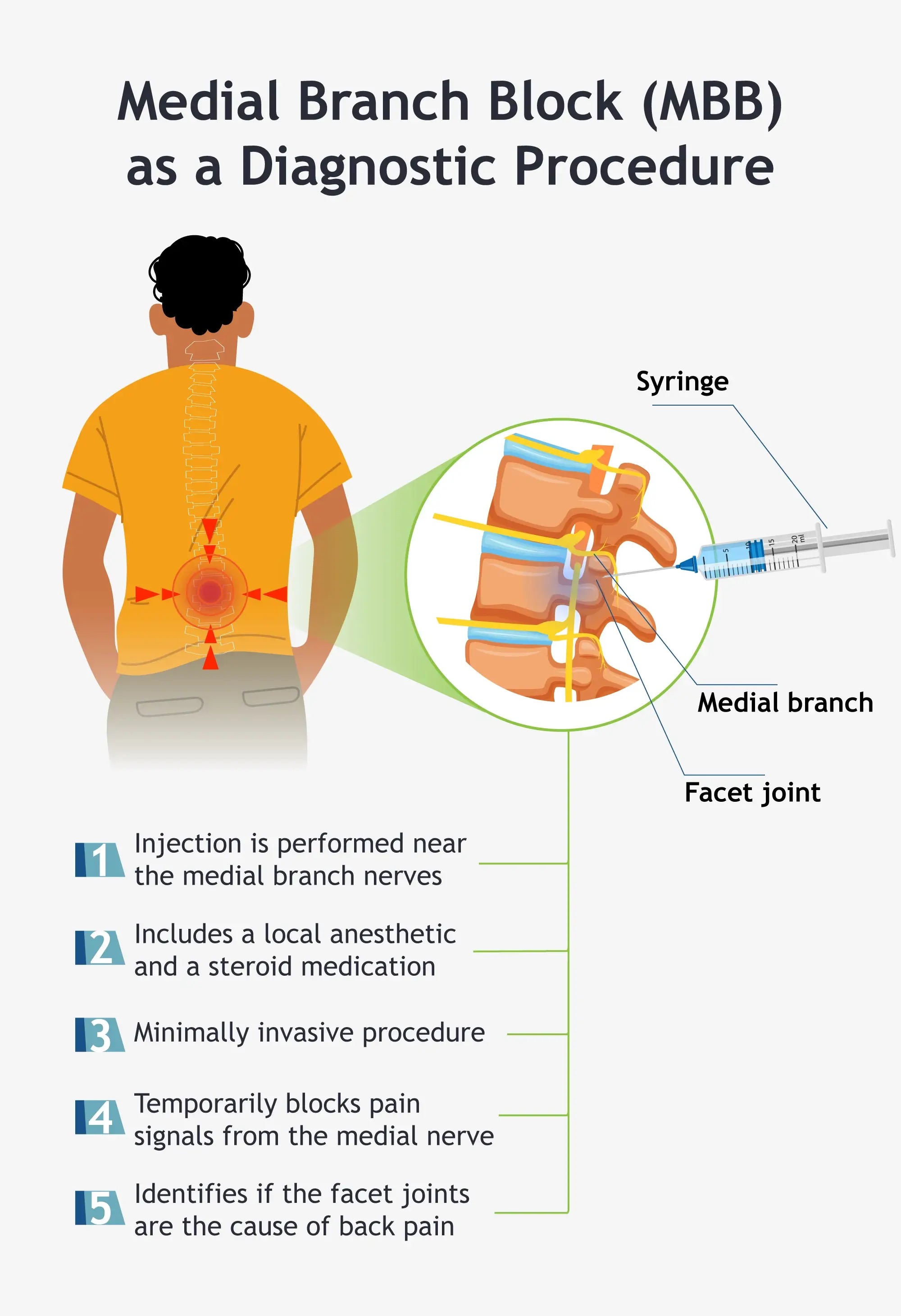 An infographic describing the medial branch block procedure.